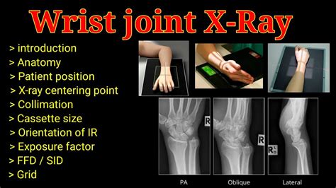 ap on wrist|pa vs ap wrist xray.